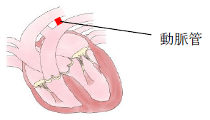 心臓の雑音が聴こえたポメラニアン（動脈管開存症）
